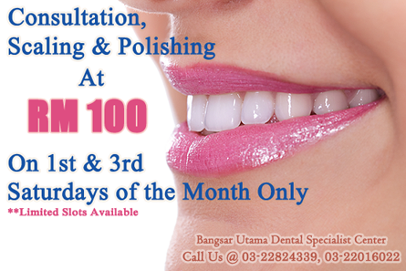 ScalingPolishing DentalPromotionBangsar-Utama-dental-specialist-center-dentistsnearby-1