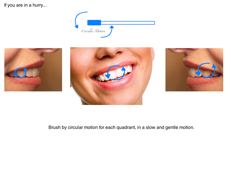 Fones method brushing