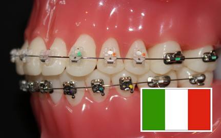 dentist3-braces-best