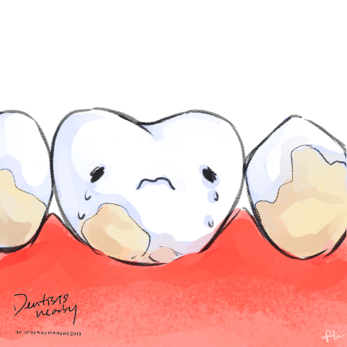 tooth-covered-with-plaque-illustration-dentistsnearby