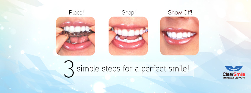 ClearSmile Invisible Aligners 1