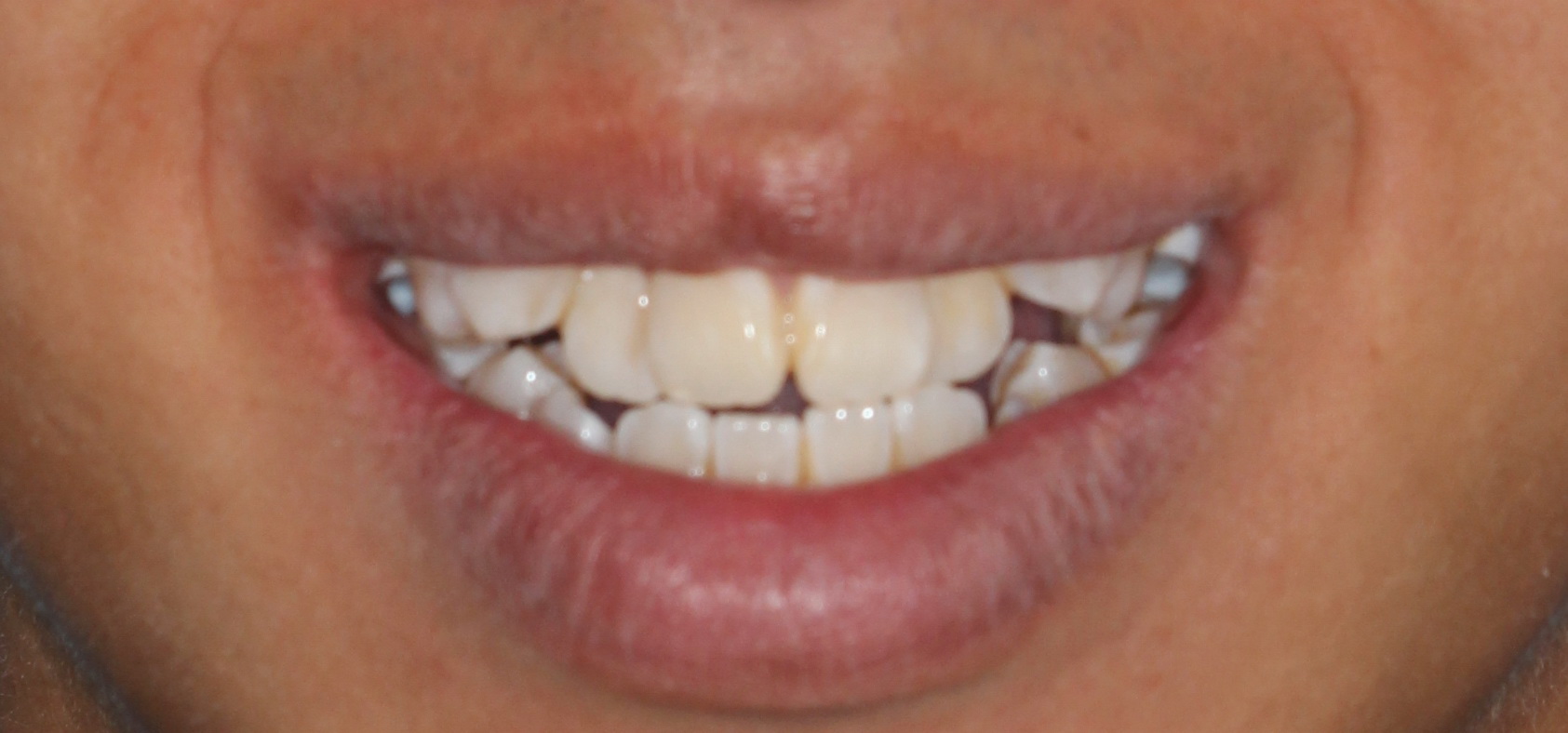 Dr-Lee-YM-All-Smile-Dental-Specialist-2