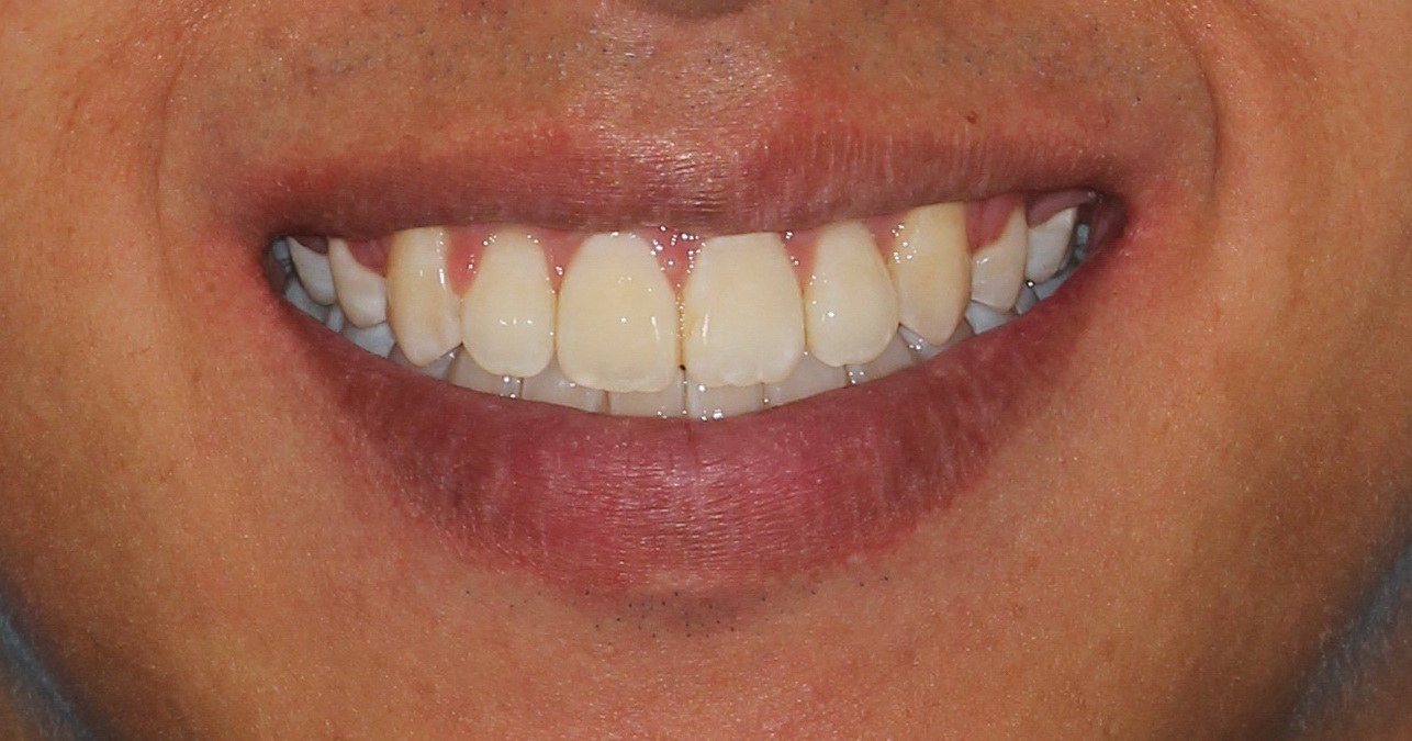 All Smile Dental Specialist (TTDI)  Dental Clinics 