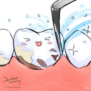 mini-tooth-dental-scaling-off-plaque-illustration-dentistsnearby