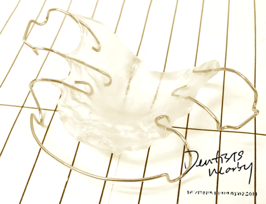 FAQs about Retainers. Dental Clinics, Dentists, Klinik Gigi & 牙医 in